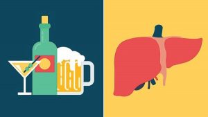 بیماری کبدی الکلی (ARLD) دقیقا چیست؟